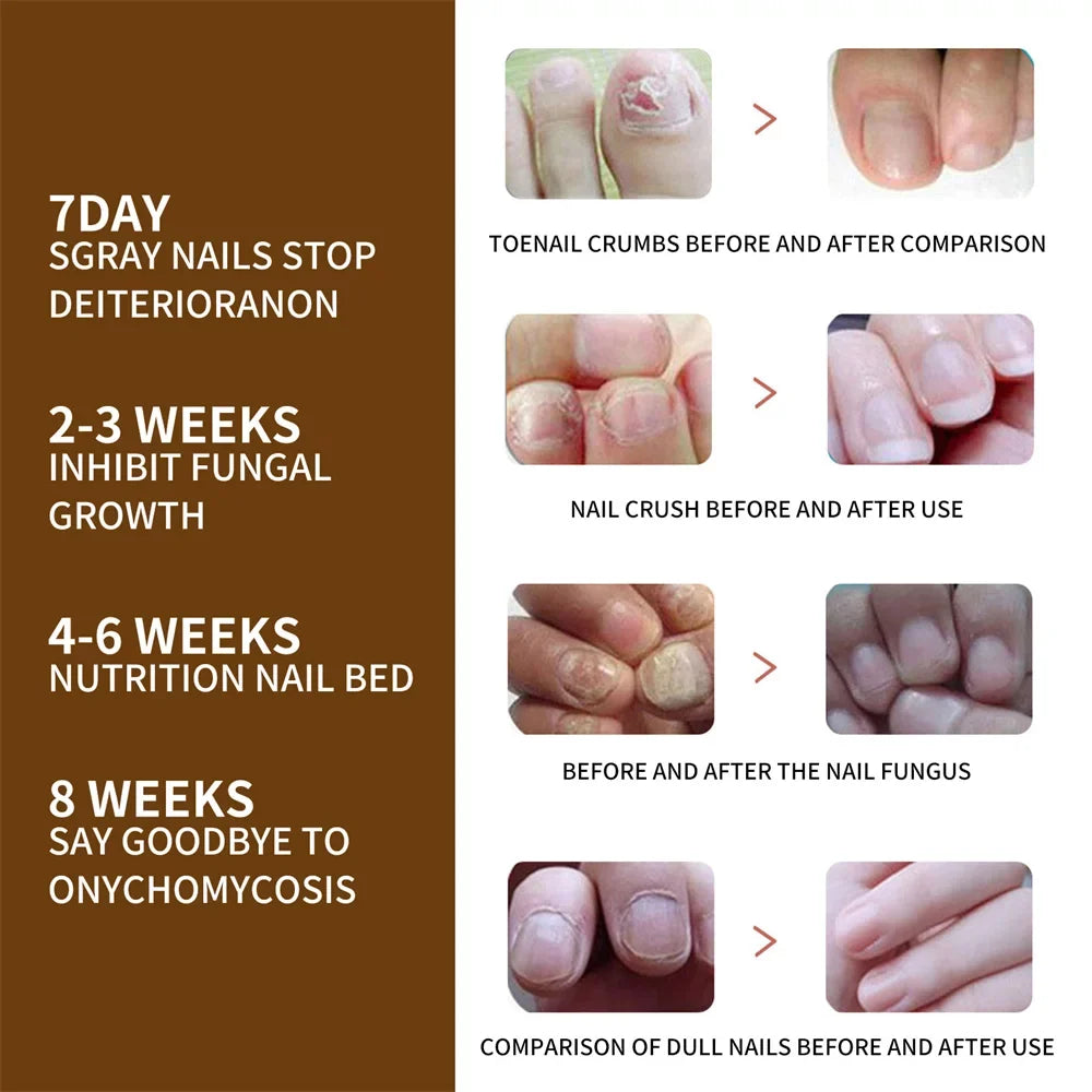 2pcs Nail Growth DeepHealing Organic Sizeerum 30ml